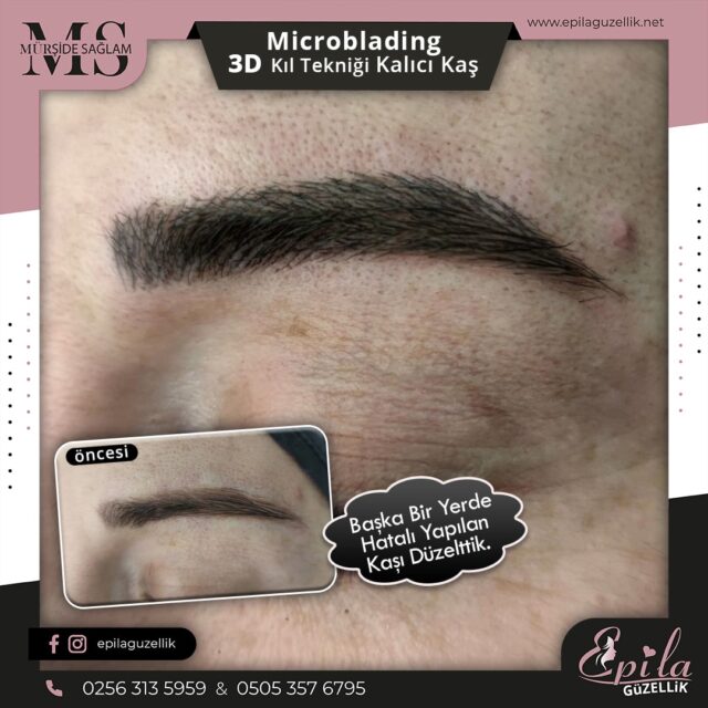 Nazilli - Microblading 3D Kıl Tekniği Kalıcı Kaş Kontürü