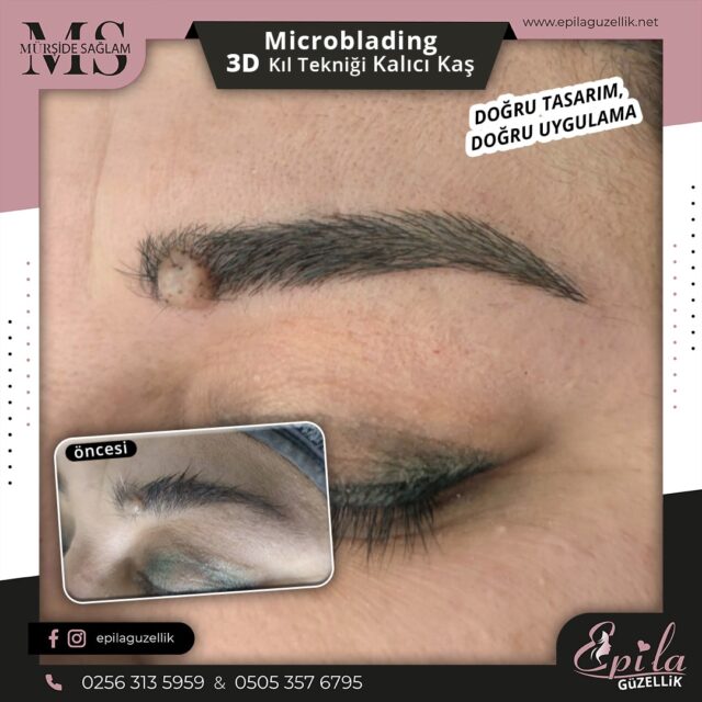 Nazilli - Microblading 3D Kıl Tekniği Kalıcı Kaş Kontürü