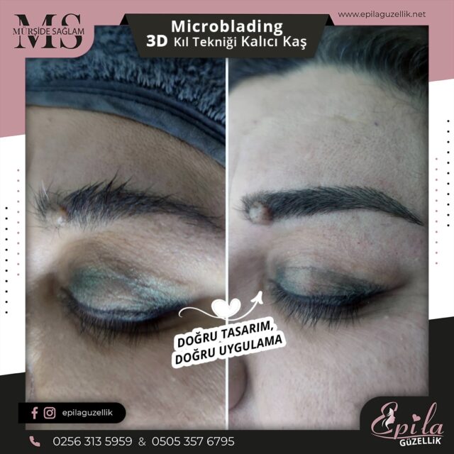 Nazilli - Microblading 3D Kıl Tekniği Kalıcı Kaş Kontürü