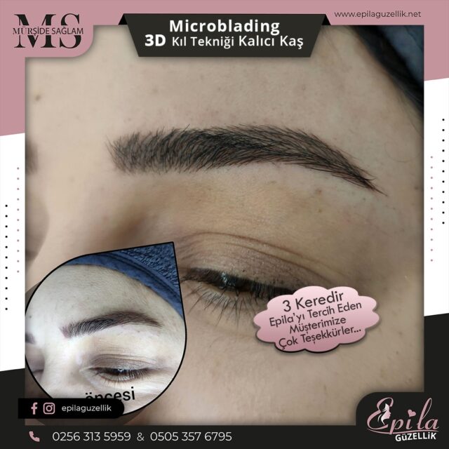 Nazilli - Microblading 3D Kıl Tekniği Kalıcı Kaş Kontürü