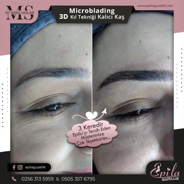 Nazilli - Microblading 3D Kıl Tekniği Kalıcı Kaş Kontürü