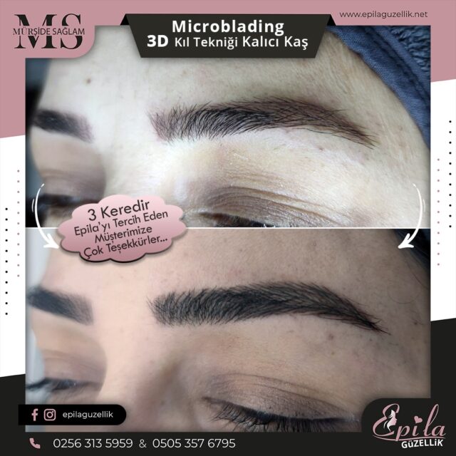 Nazilli - Microblading 3D Kıl Tekniği Kalıcı Kaş Kontürü