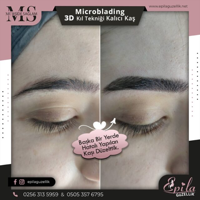 Nazilli - Microblading 3D Kıl Tekniği Kalıcı Kaş Kontürü