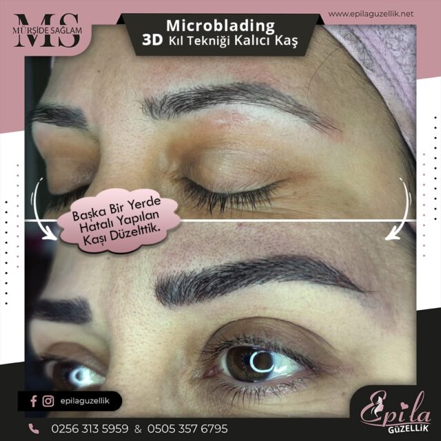 Nazilli - Microblading 3D Kıl Tekniği Kalıcı Kaş Kontürü