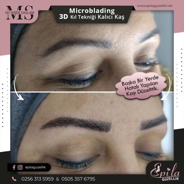 Nazilli - Microblading 3D Kıl Tekniği Kalıcı Kaş Kontürü