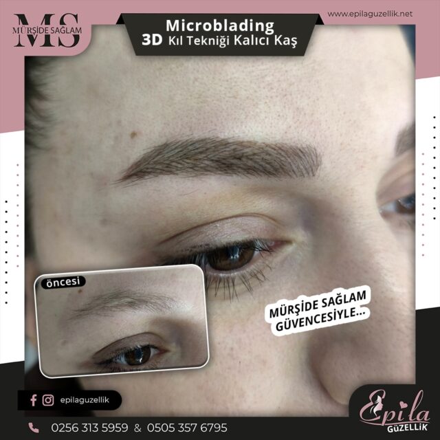 Nazilli - Microblading 3D Kıl Tekniği Kalıcı Kaş Kontürü