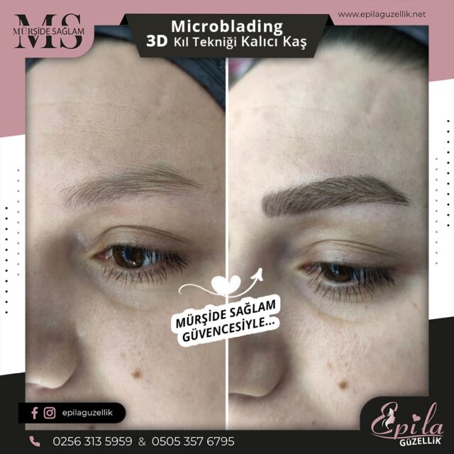 Nazilli - Microblading 3D Kıl Tekniği Kalıcı Kaş Kontürü