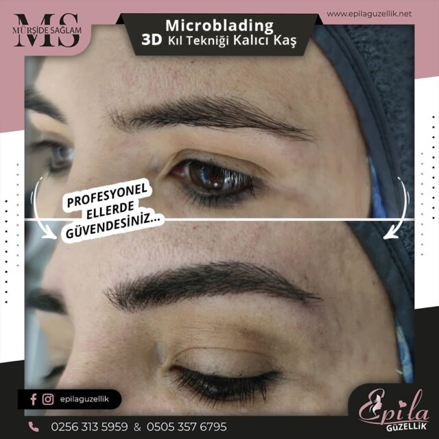 Nazilli - Microblading 3D Kıl Tekniği Kalıcı Kaş Kontürü