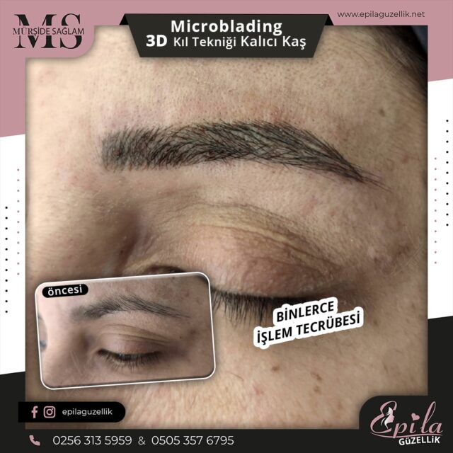 Nazilli - Microblading 3D Kıl Tekniği Kalıcı Kaş Kontürü