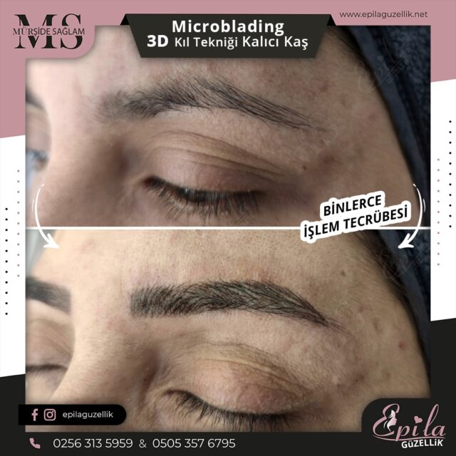 Nazilli - Microblading 3D Kıl Tekniği Kalıcı Kaş Kontürü