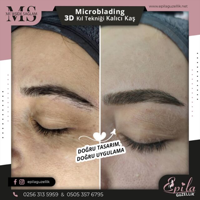 Nazilli - Microblading 3D Kıl Tekniği Kalıcı Kaş Kontürü