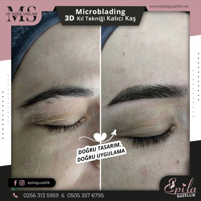 Nazilli - Microblading 3D Kıl Tekniği Kalıcı Kaş Kontürü