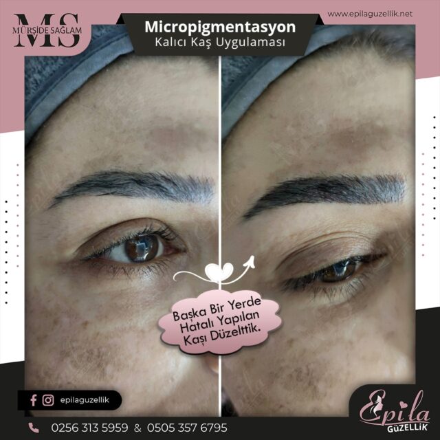 Nazilli - Microblading 3D Kıl Tekniği Kalıcı Kaş Kontürü