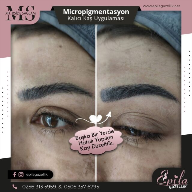 Nazilli - Microblading 3D Kıl Tekniği Kalıcı Kaş Kontürü