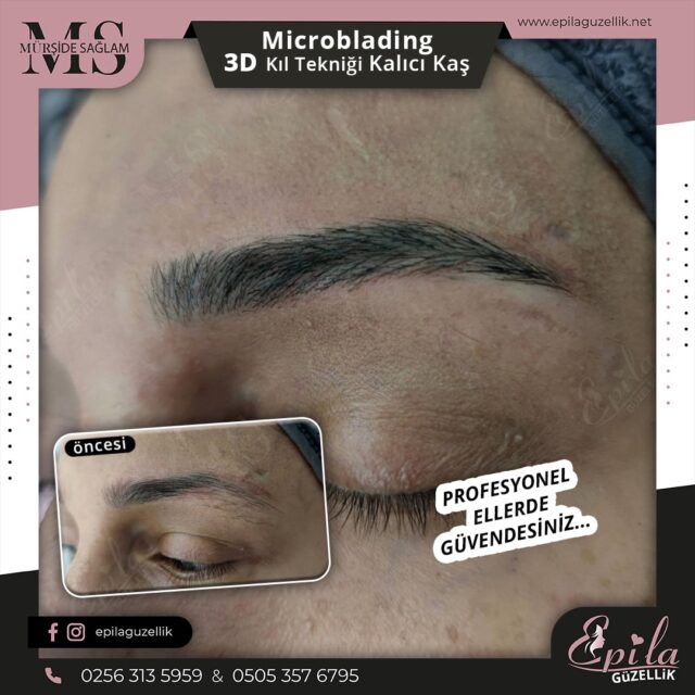 Nazilli - Microblading 3D Kıl Tekniği Kalıcı Kaş Kontürü