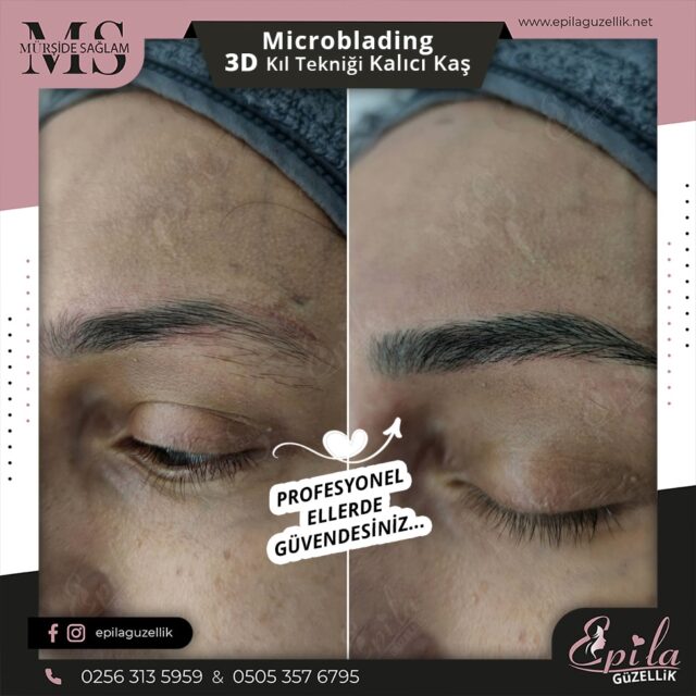 Nazilli - Microblading 3D Kıl Tekniği Kalıcı Kaş Kontürü