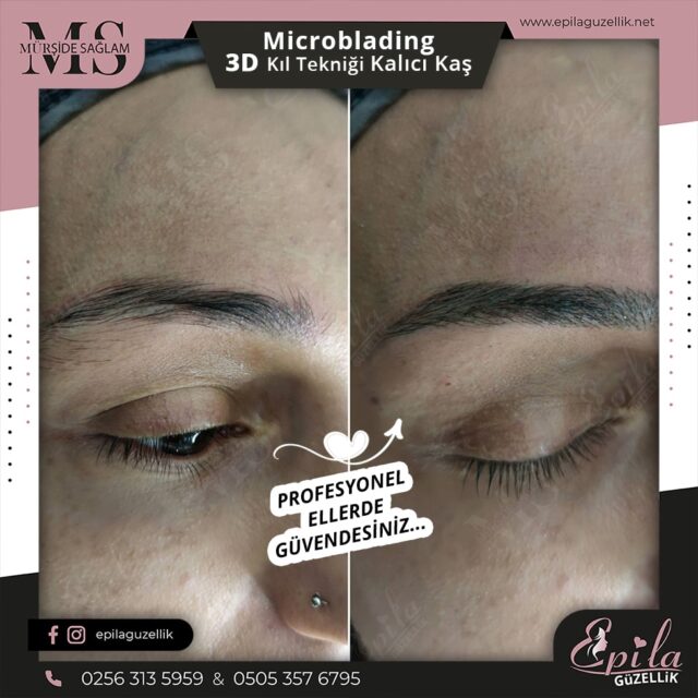 Nazilli - Microblading 3D Kıl Tekniği Kalıcı Kaş Kontürü