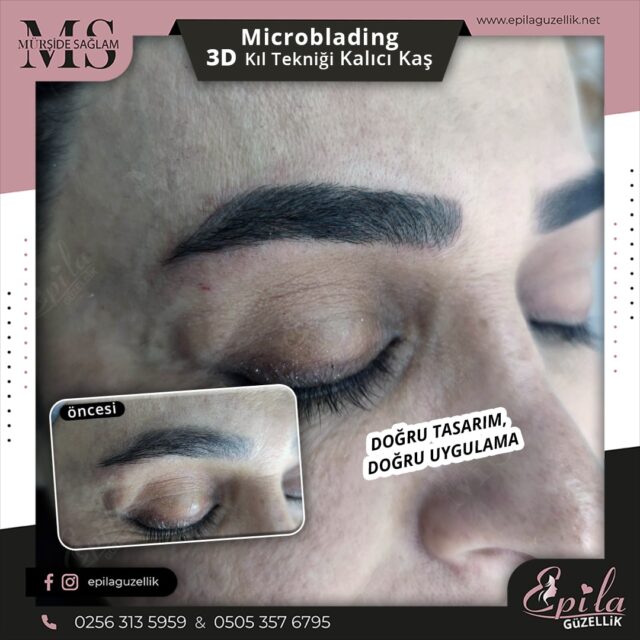 Nazilli - Microblading 3D Kıl Tekniği Kalıcı Kaş Kontürü