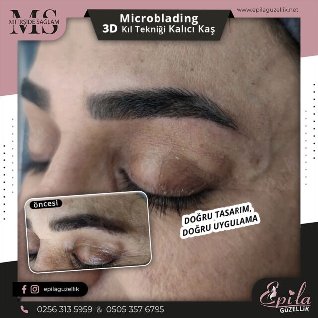 Nazilli - Microblading 3D Kıl Tekniği Kalıcı Kaş Kontürü