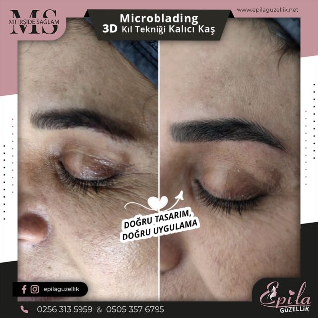 Nazilli - Microblading 3D Kıl Tekniği Kalıcı Kaş Kontürü