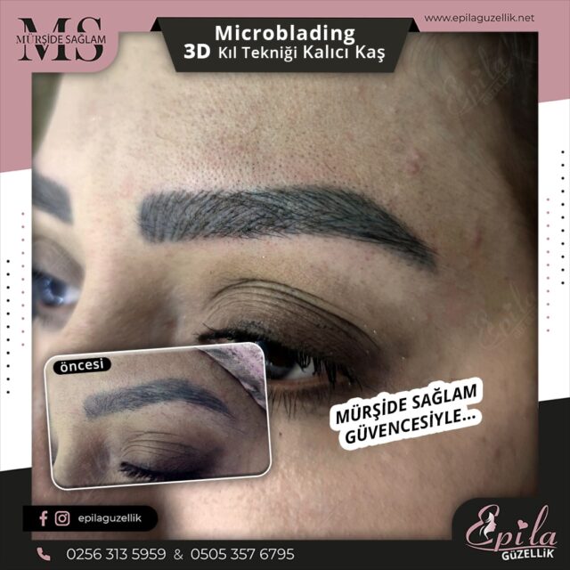 Nazilli - Microblading 3D Kıl Tekniği Kalıcı Kaş Kontürü