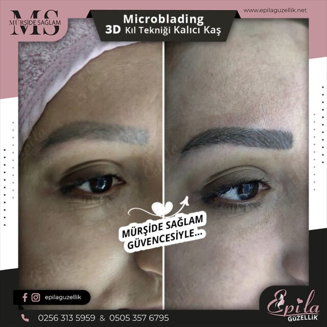 Nazilli - Microblading 3D Kıl Tekniği Kalıcı Kaş Kontürü