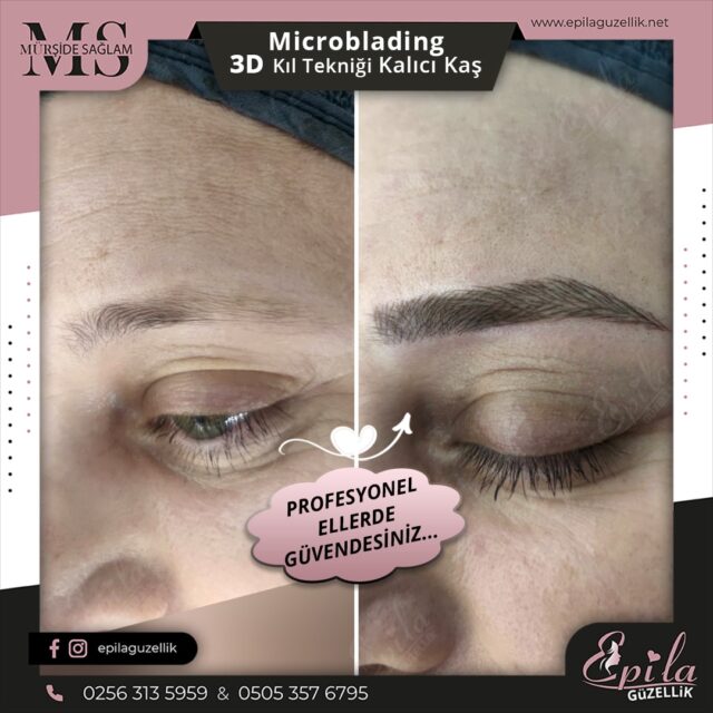 Nazilli - Microblading 3D Kıl Tekniği Kalıcı Kaş Kontürü