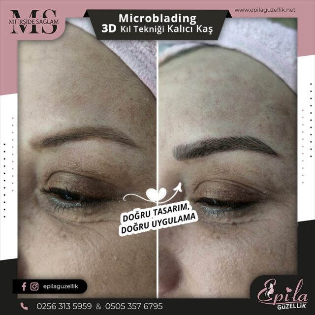 Nazilli - Microblading 3D Kıl Tekniği Kalıcı Kaş Kontürü