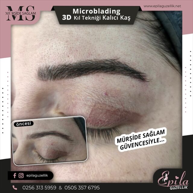 Nazilli - Microblading 3D Kıl Tekniği Kalıcı Kaş Kontürü