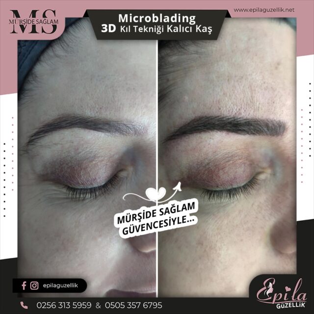 Nazilli - Microblading 3D Kıl Tekniği Kalıcı Kaş Kontürü