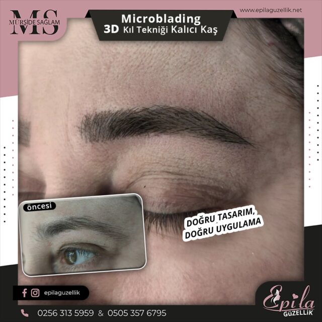 Nazilli - Microblading 3D Kıl Tekniği Kalıcı Kaş Kontürü