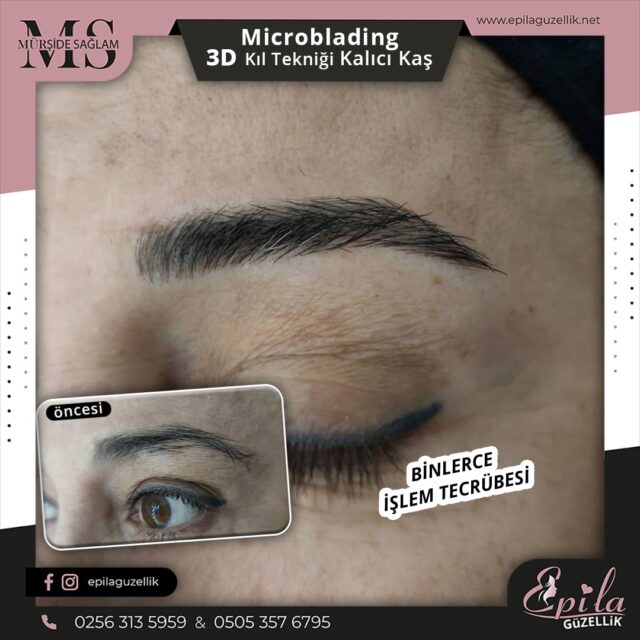 Nazilli - Microblading 3D Kıl Tekniği Kalıcı Kaş Kontürü