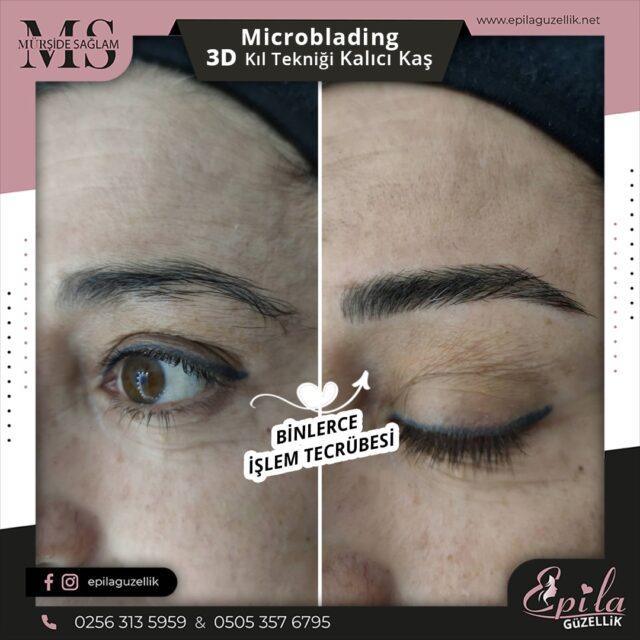 Nazilli - Microblading 3D Kıl Tekniği Kalıcı Kaş Kontürü