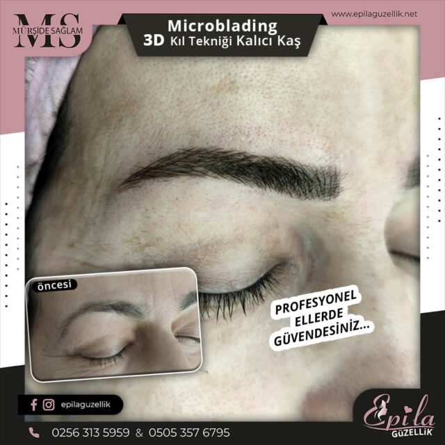 Nazilli - Microblading 3D Kıl Tekniği Kalıcı Kaş Kontürü