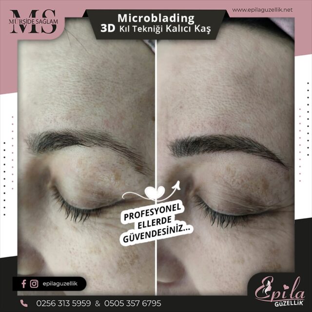 Nazilli - Microblading 3D Kıl Tekniği Kalıcı Kaş Kontürü