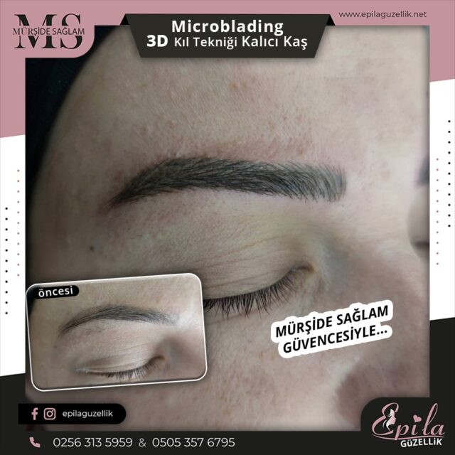 Nazilli - Microblading 3D Kıl Tekniği Kalıcı Kaş Kontürü