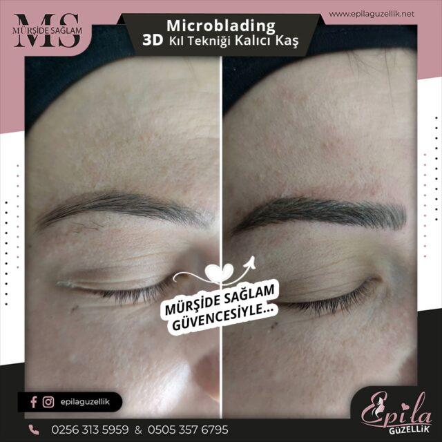 Nazilli - Microblading 3D Kıl Tekniği Kalıcı Kaş Kontürü