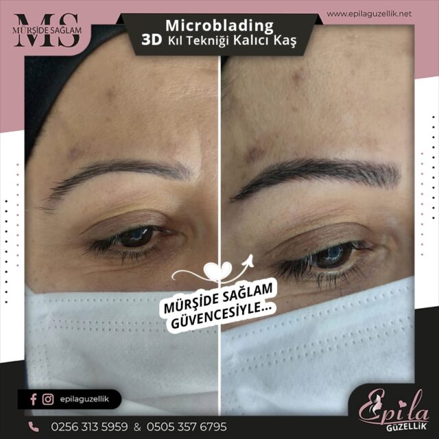 Nazilli - Microblading 3D Kıl Tekniği Kalıcı Kaş Kontürü