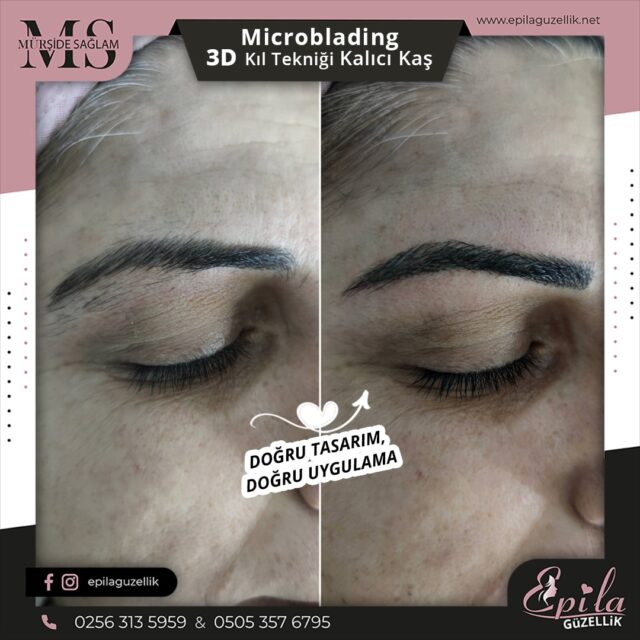 Nazilli - Microblading 3D Kıl Tekniği Kalıcı Kaş Kontürü