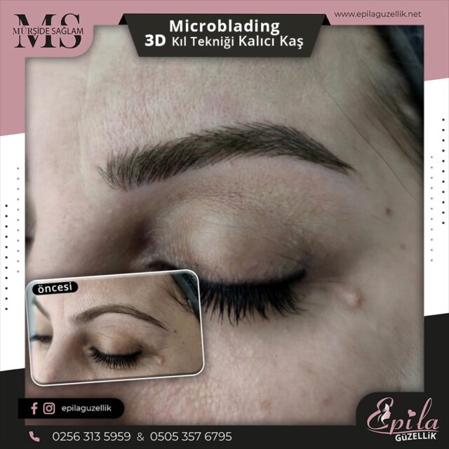 Nazilli - Microblading 3D Kıl Tekniği Kalıcı Kaş Kontürü