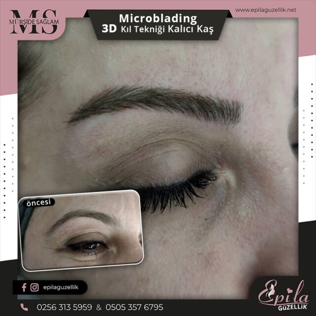 Nazilli - Microblading 3D Kıl Tekniği Kalıcı Kaş Kontürü