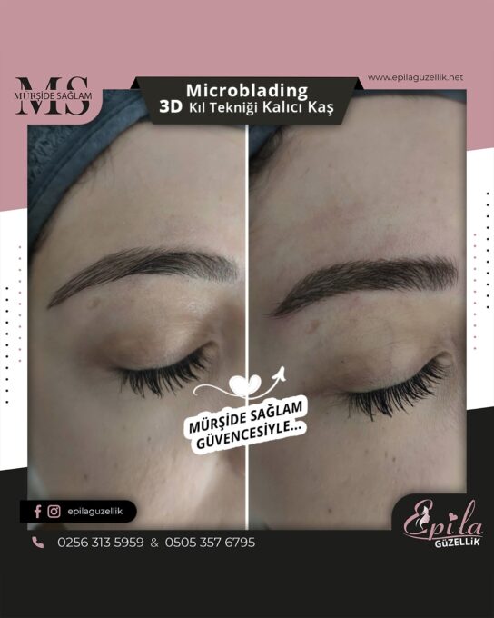 Nazilli - Microblading 3D Kıl Tekniği Kalıcı Kaş Kontürü