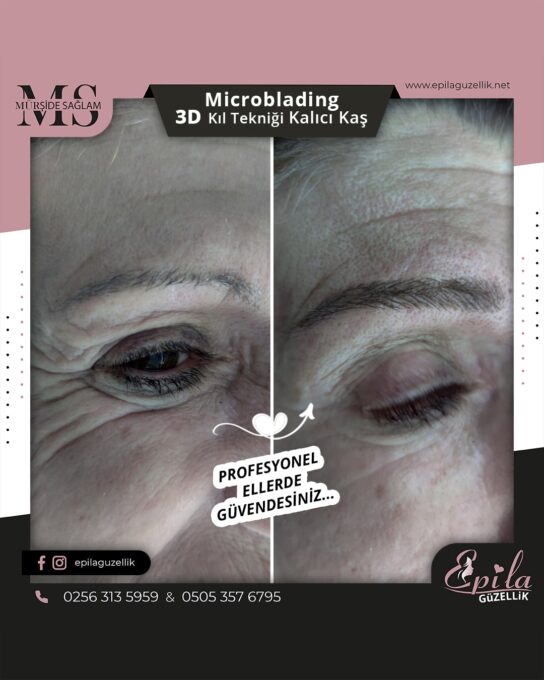 Nazilli - Microblading 3D Kıl Tekniği Kalıcı Kaş Kontürü