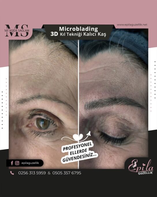 Nazilli - Microblading 3D Kıl Tekniği Kalıcı Kaş Kontürü