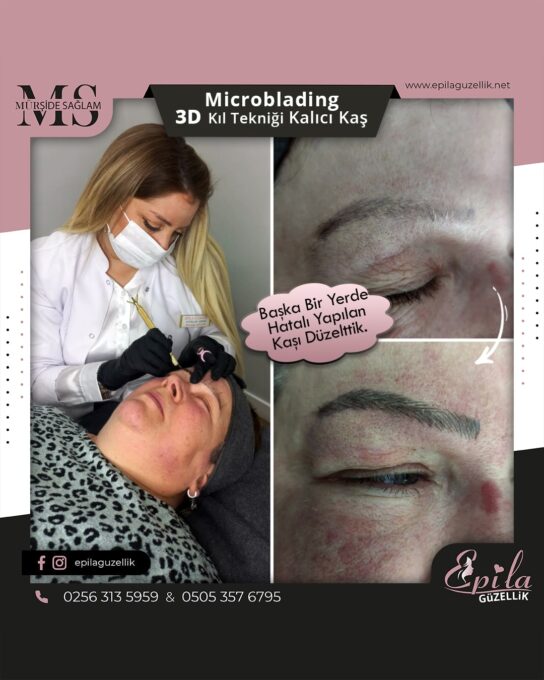 Nazilli - Microblading 3D Kıl Tekniği Kalıcı Kaş Kontürü