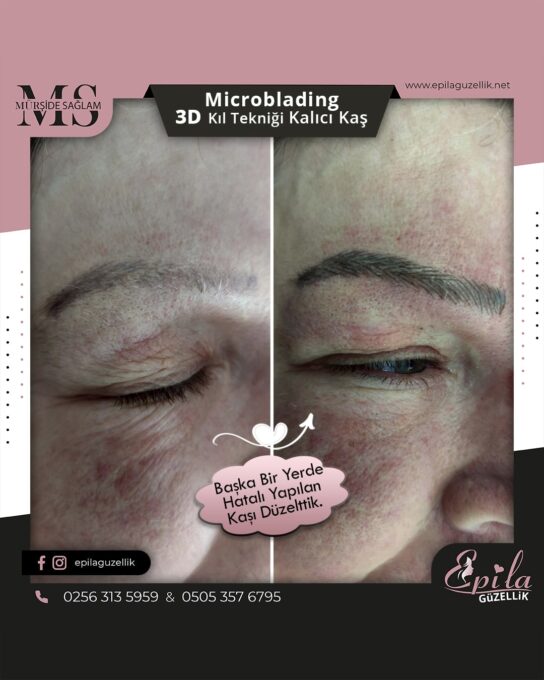 Nazilli - Microblading 3D Kıl Tekniği Kalıcı Kaş Kontürü