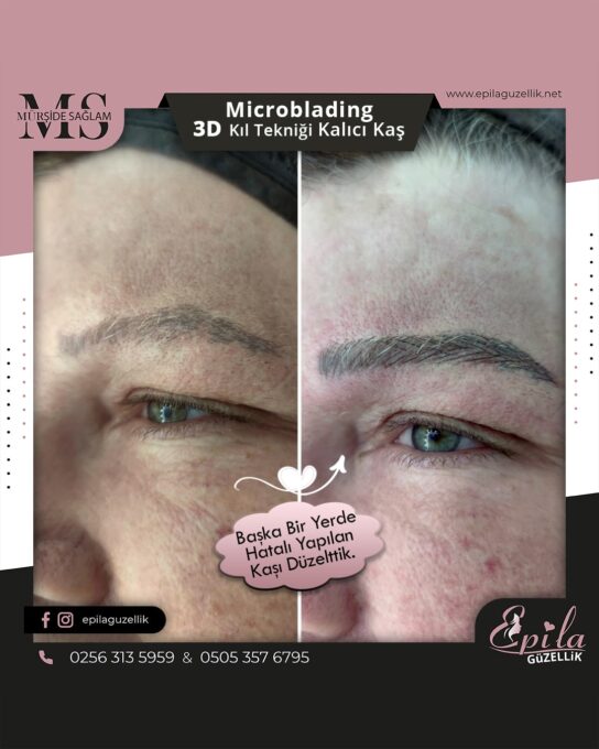 Nazilli - Microblading 3D Kıl Tekniği Kalıcı Kaş Kontürü