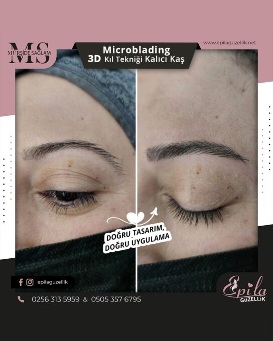 Nazilli - Microblading 3D Kıl Tekniği Kalıcı Kaş Kontürü