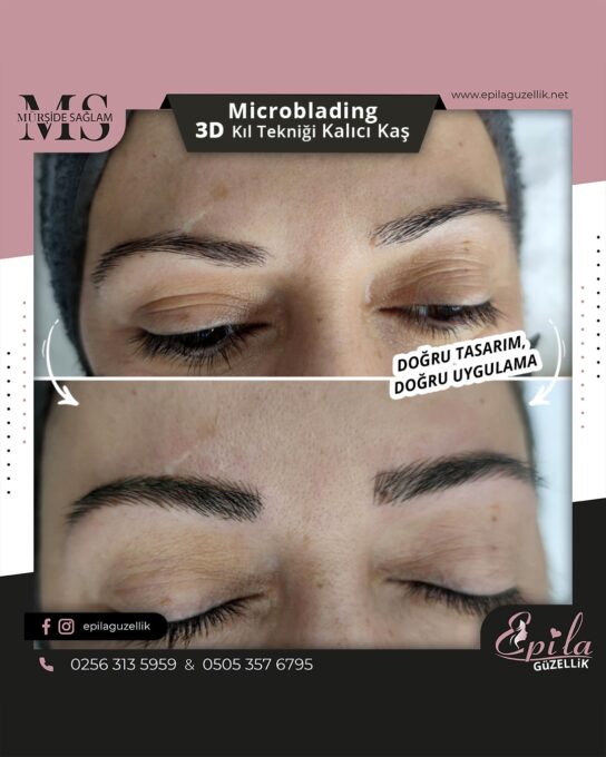 Nazilli - Microblading 3D Kıl Tekniği Kalıcı Kaş Kontürü