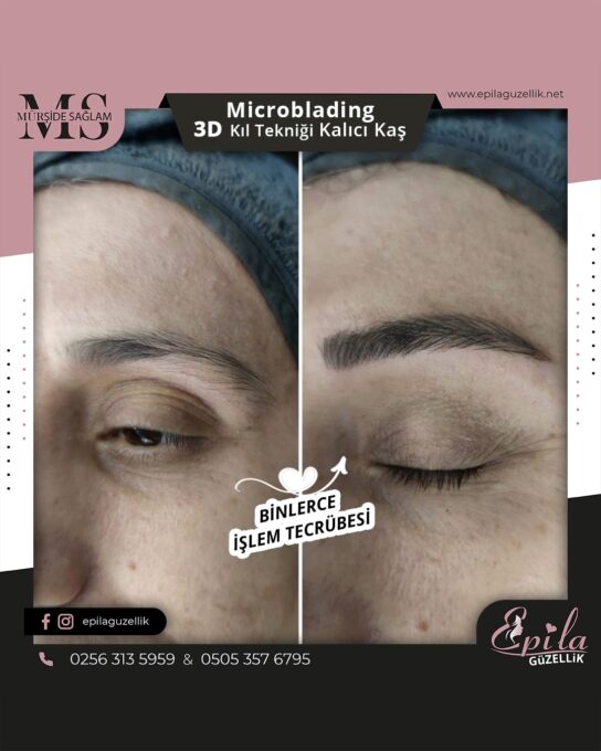 Nazilli - Microblading 3D Kıl Tekniği Kalıcı Kaş Kontürü